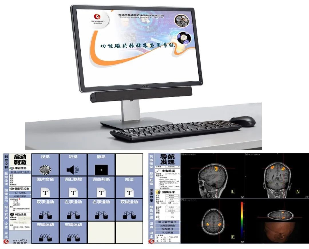 1673229565481052.jpg 刺激任务.jpg