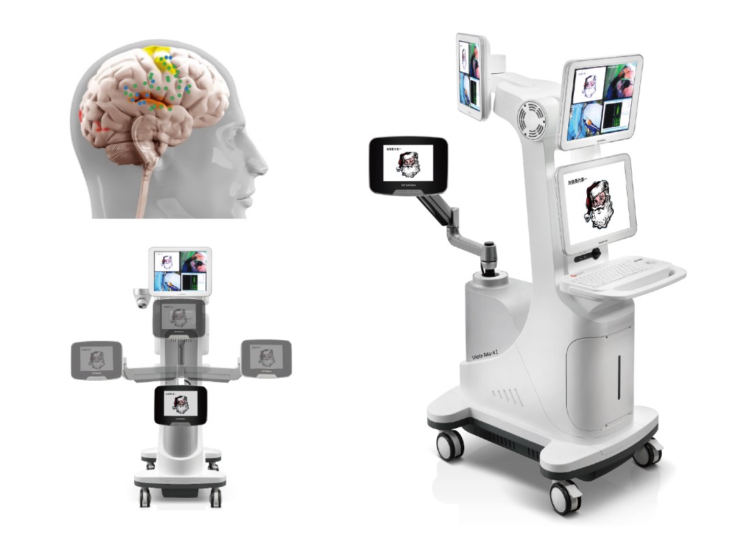 1673229622103142.jpg 脑功能术中刺激系统.jpg